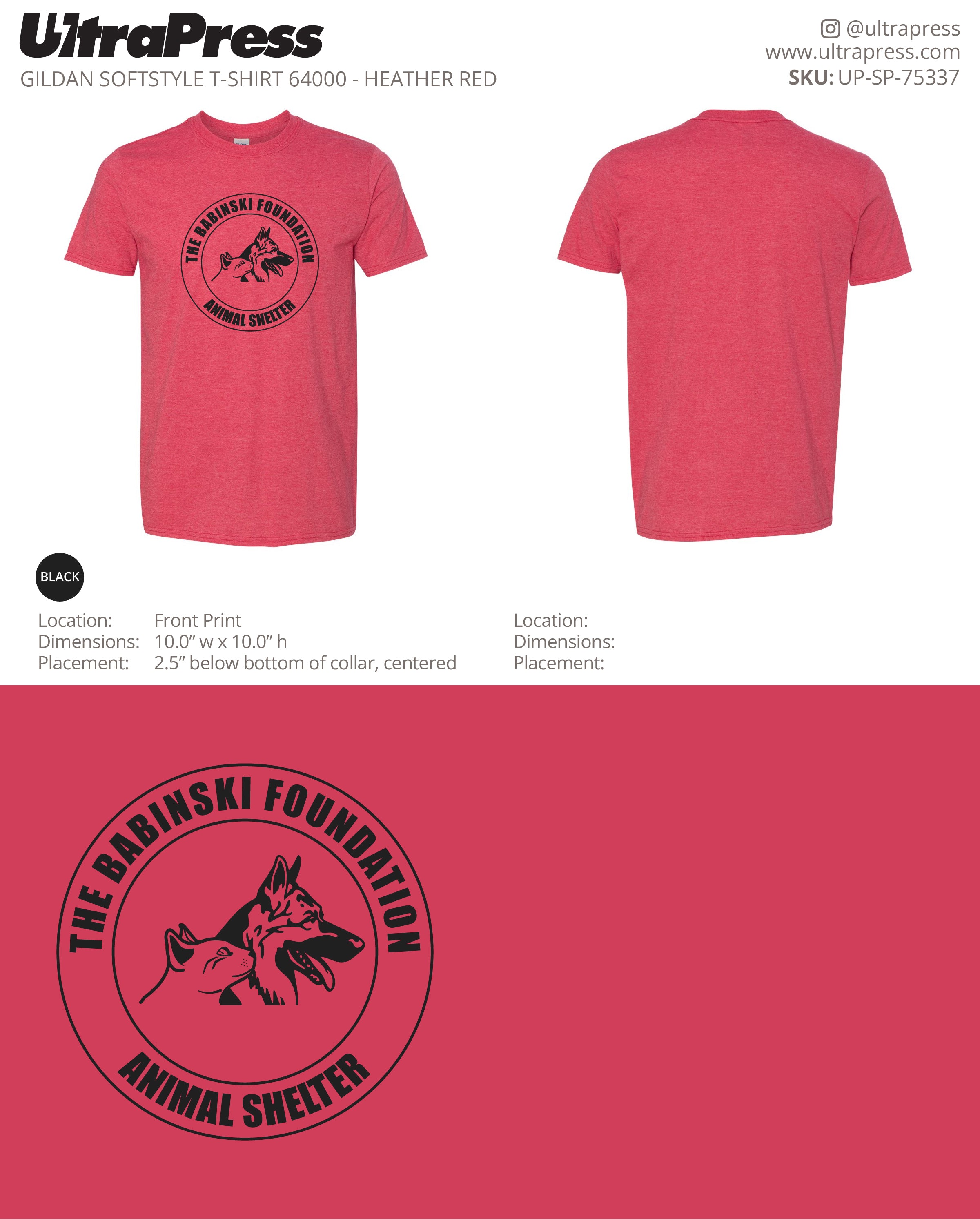 UP-SP-75337 The Babinski Foundation - Donna Sutton 100 Min Qty (Bulk)