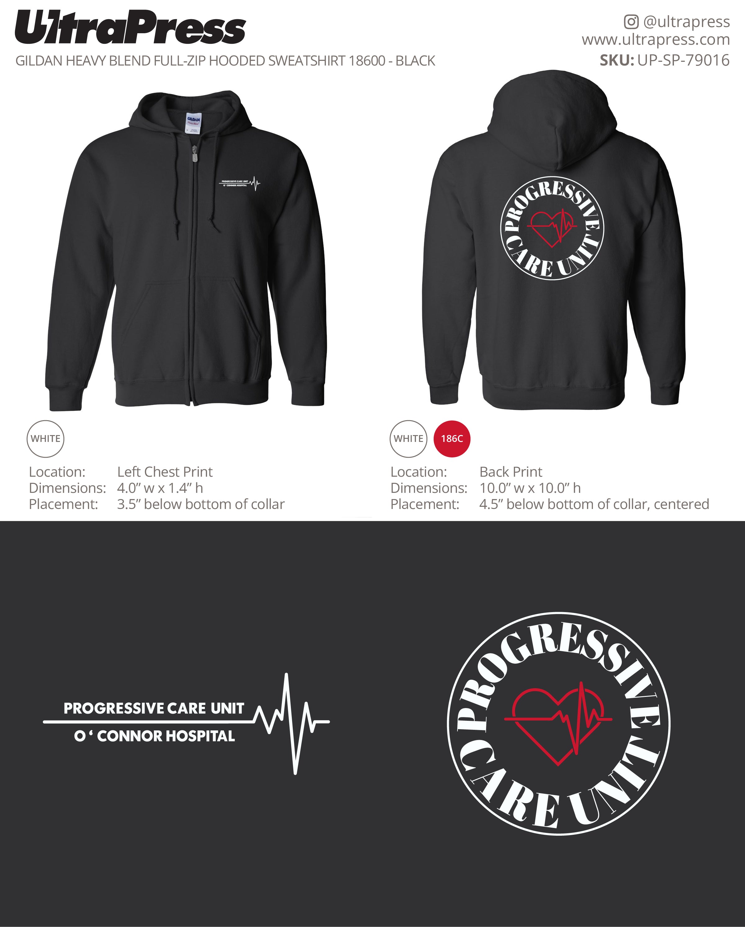 UP-SP-79016 PROGRESSIVE CARE UNIT O'Connor Hospital - Leslie Luong 72 Min Qty (Bulk)