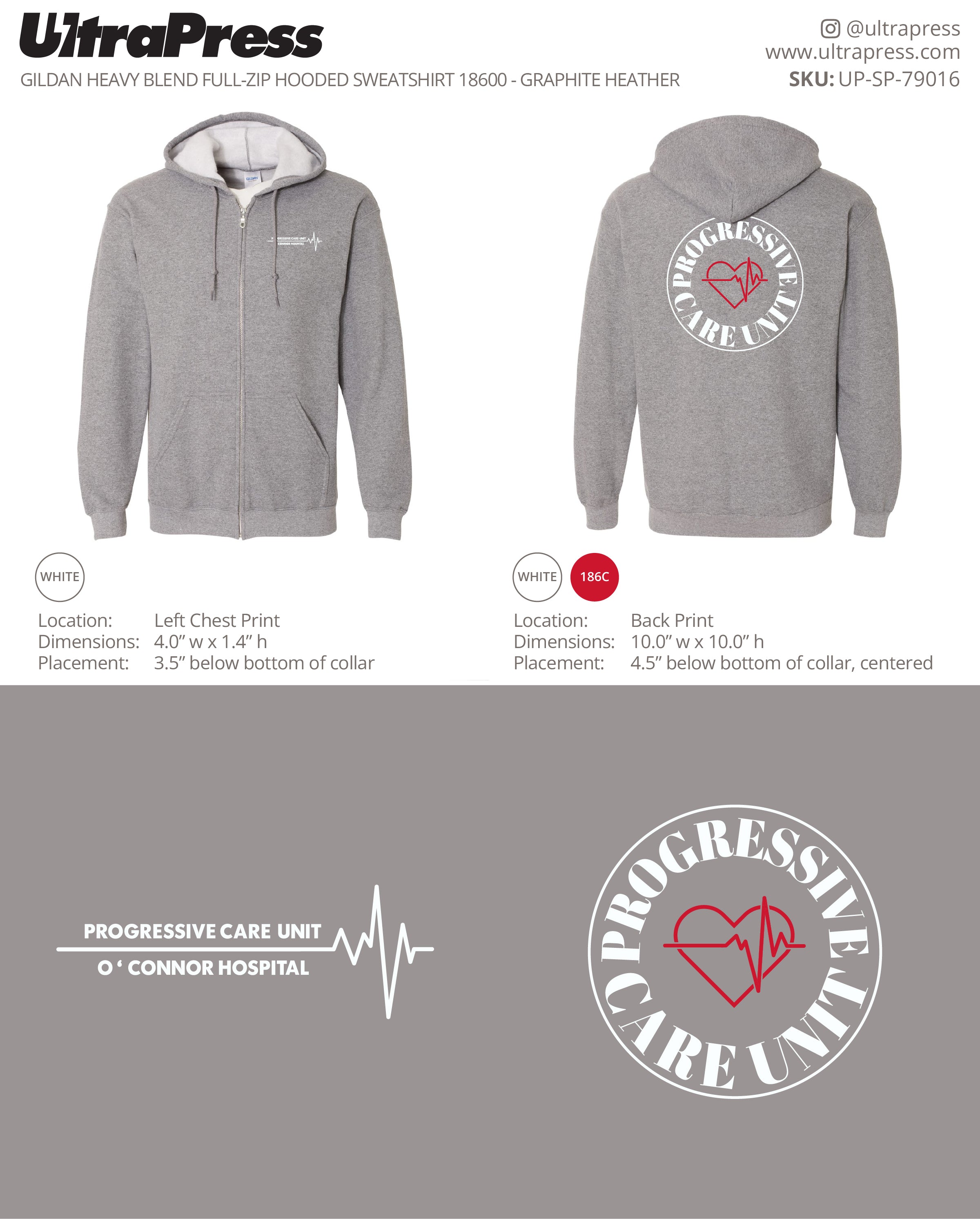 UP-SP-79016 PROGRESSIVE CARE UNIT O'Connor Hospital - Leslie Luong 72 Min Qty (Bulk)